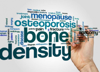 Osteoporosis and what Women need to know