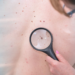 Magnifying Melanoma