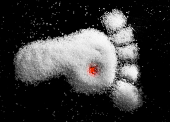 Joining the dots… Diabetes Mellitus and Foot Disease