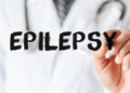 Epilepsy