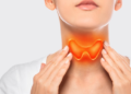 Hypothyroidism: What it looks like and treatment options