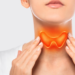 Hypothyroidism: What it looks like and treatment options