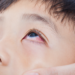 Conjunctivitis in Children: The Pharmacy Role