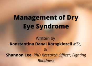 Management of Dry Eye Syndrome