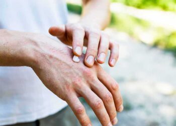 CPD: Management of Common Skin Conditions