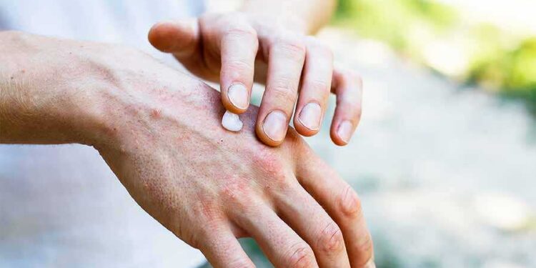 CPD: Management of Common Skin Conditions