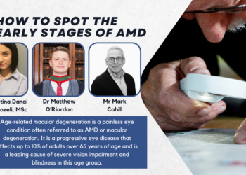 How to Spot the Early Stages of AMD