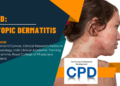 CPD: Management of Atopic Dermatitis