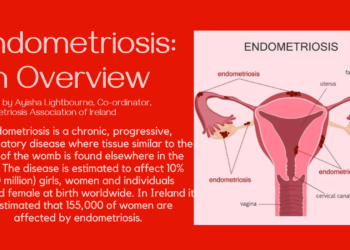 Endometriosis: An Overview