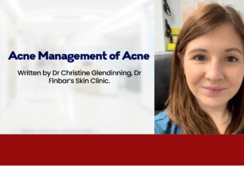 Acne: Management of Acne