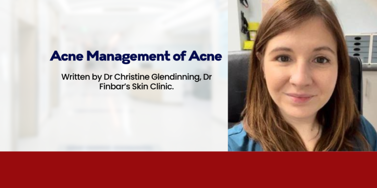 Acne: Management of Acne