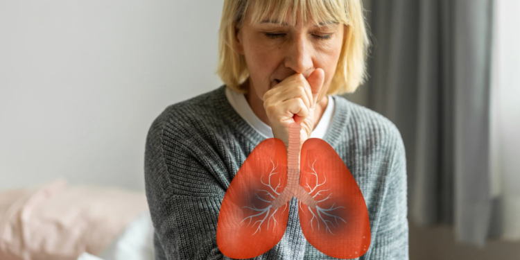 Management of Cough in Pharmacy